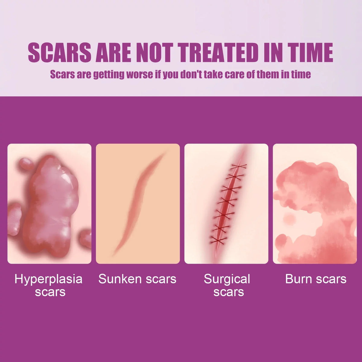 Scar Scar Removal Repair Scar Skin 50ml Repair Cream 2PCS and Cream Removal